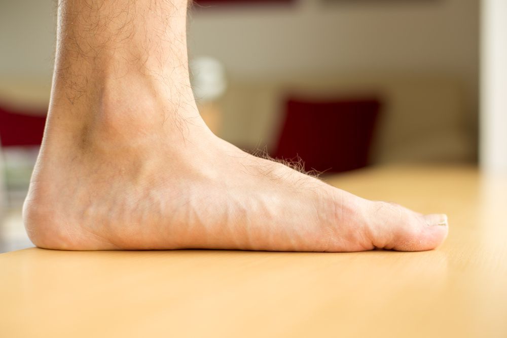 صافی کف پا چیست ؟ | درمان بیماری کف پای صاف