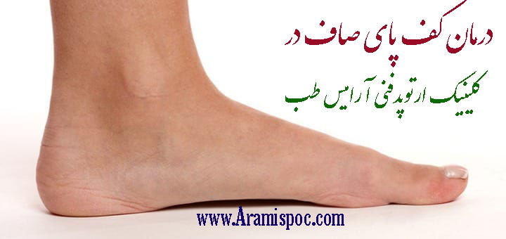 درمان کف پای صاف بدون جراحی