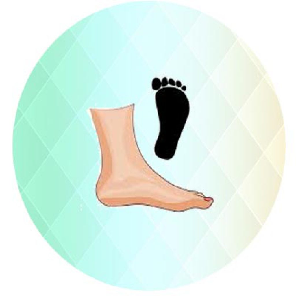 درمان کف پای صاف بدون عمل جراحی
