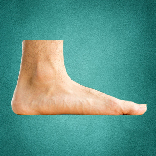 درمان کف پای صاف
